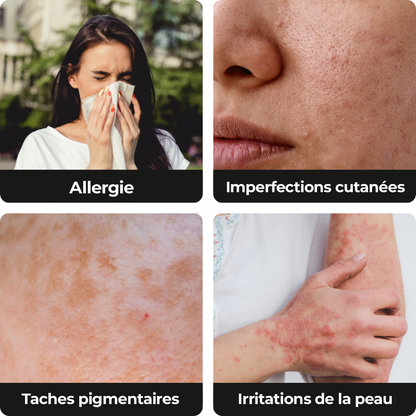 Aspirateur à main UV AlergoVac™